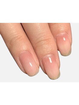 爪の悩みを解消できる（ケア含む）