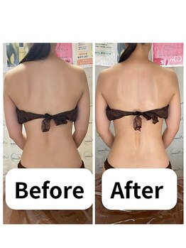 ニコノ(Nicono)/ 背中すっきり美ライン