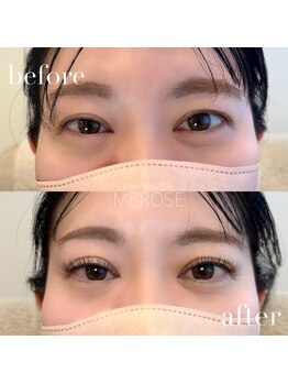 メローズ(Merose)/