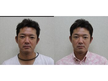 那覇小顔センター/