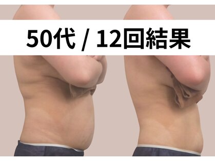 リストアミー(Restore me)の写真