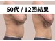 リストアミー(Restore me)の写真