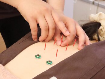 カラーズ(colors)/温活と鍼灸で効果を最大に!