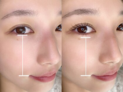 リトマス(LITMUS)の写真