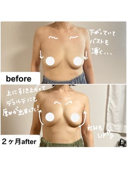 つばききよら/50代で引きあがるバスト！