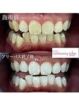 エクシアホワイト 立川南口店/ビフォーアフター