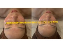 アロマビューティーサロン ジェイハウス(J)/