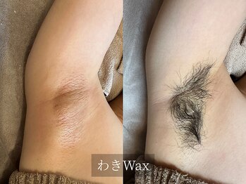 アルム(Arum)/わきWax