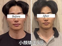 スピード小顔 渋谷店 (Speed)/小顔矯正でメンズもモテ小顔に◎
