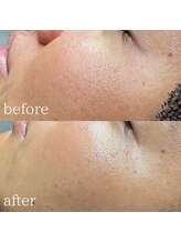 エメリーヌ(AIMELINE)/クリスティーナ　ビオフィート