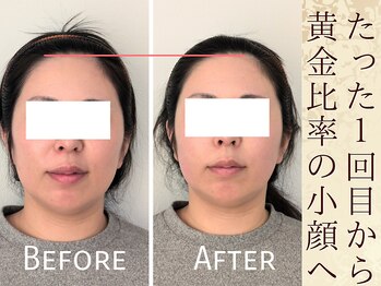 スウ(suu.)/Before-After【30代】1回