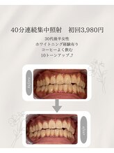 プラスビーセルフ(+b self)/ホワイトニングビフォーアフター