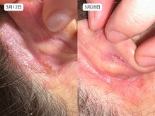 レイル(REIR)/ピュールボーテ/富士の不動水