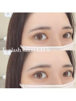 リリー(LILY.)/目元パッチ！リラッシュリフト◎