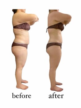 フラワー(flower)/