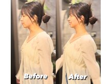 コルミチョン サロン(骨美整 salon)/歩き方　Before・After