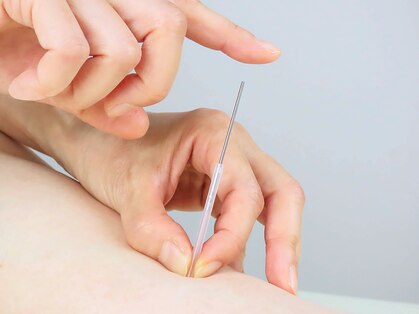 御茶の水ドライN鍼灸の写真