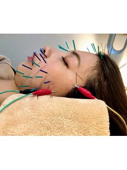 鍼灸施術を受けたい