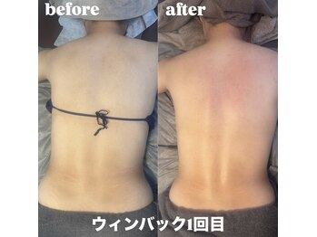 ココプラス 麻布十番(COCOplus)/before after