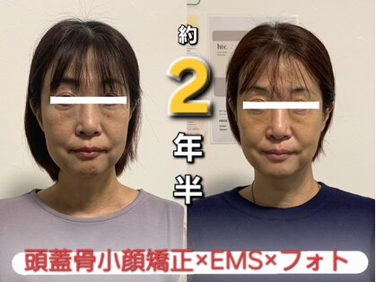 ロメリア(Roemeria)の写真