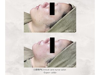 エスポワールカルド(Espoir caldo)/