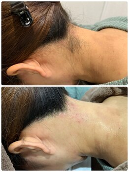 エリーザベル(Elisa Bell)/襟足美人