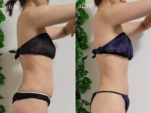 ティティビューティ ラ・クエージ金山(TTBeauty)/見た目痩せ♪