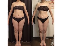 美やせ専門店 ビープロデュース 西尾店(B'PRODUCE)/【50代の方のビフォーアフター】