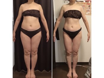 美やせ専門店 ビープロデュース 西尾店(B'PRODUCE)/【50代の方のビフォーアフター】