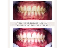 ブライト 八王子(bright)の雰囲気（はじめての方にも♪満足度の高い効果が実感できる本格美白ケア）