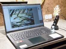 エクスポール(EXPOR)/マイクロスコープ診断