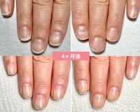 サンネイル(Sun nail)