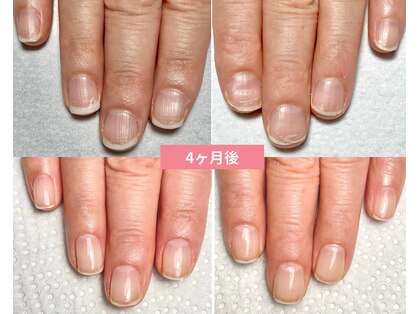サンネイル(Sun nail)の写真