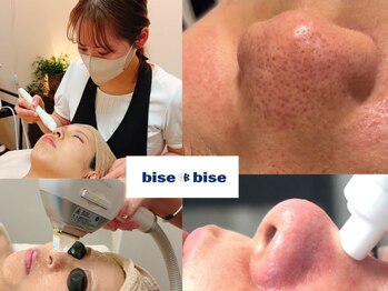 ビズビズ 天王寺店(bisebise)の写真/長年の毛穴悩みに終止符！毛穴黒ずみ角栓除去～毛穴開きまで肌構造に着目した毛穴改善に特化した専門ケア