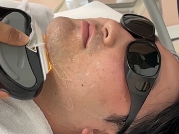アロマ(AROMA)の写真/ヒゲ脱毛×肌荒れ改善!敏感肌・ニキビ肌もOK。清潔感UPと肌質改善が同時に叶う、メンズ美肌脱毛◎