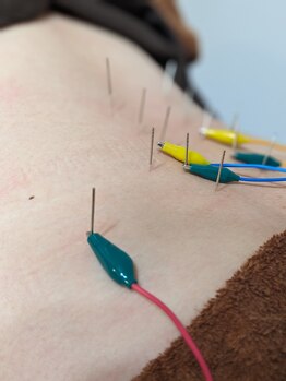 乃々鍼灸整体院 表参道/鍼灸×整体