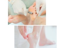 パールズ(PEARLS)の雰囲気（施術数も多いから巻爪や頑固な角質もしっかり綺麗に整い満足度◎）