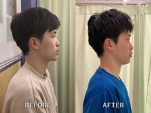 整音(totonone)/巻き肩、目、眉毛のハリ