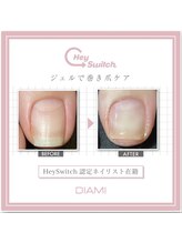 ループ(LOOP)/最新巻き爪ケア