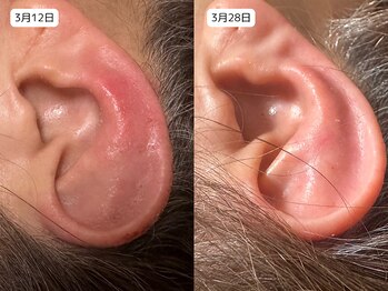 レイル(REIR)/ピュールボーテ/富士の不動水