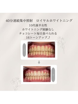 プラスビーセルフ(+b self)/ビフォーアフター