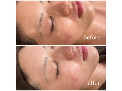 ポルボ(POLBO)の写真