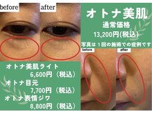 アクティブエイジング 金沢新竪町店の雰囲気（エンビロンメニューでの症例写真☆お悩みに応じてご選択可能♪）