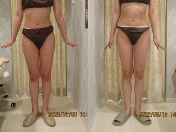 プロラボスパ 倉敷店/30代前半　症例写真