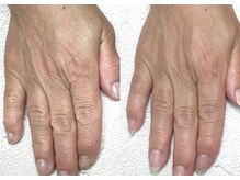 ネイルサロン ミノアッカ(mino'aka)の雰囲気（細胞を活性化！コラーゲン生成を促進するハンドエステ）