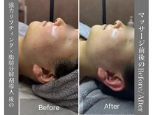 グロウ(glow.)/お仕上げマッサージ前後