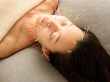 トナリ鍼灸院の雰囲気（美顔鍼施術はセラピスト歴20年の鍼灸師自慢のメニューです）