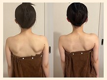 ラフリー 武蔵小杉院(RUFFREE)/肩甲骨はがし整体【武蔵小杉】