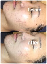 ドシル(DOCILE)/約1.5ヶ月の変化です！