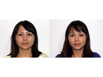 那覇小顔センター/